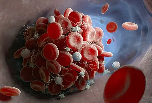 White blood cell counts that are too high or too low may be dangerous, depending on the cause. Infection can cause spikes, as well as blood cancers and other conditions.