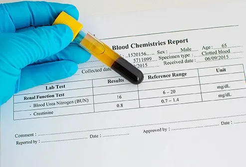 What Are Normal Blood Creatinine Levels?
