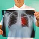 Lung Cancer Quiz